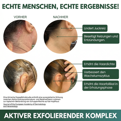 LISSIMA Natürliches Kopfhautpeeling – bei schuppiger, juckender und gereizter Kopfhaut